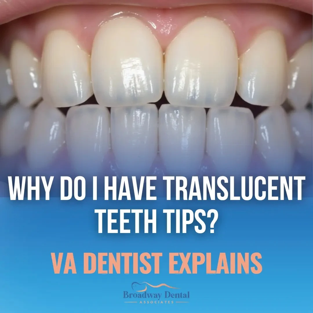 Extreme close-up of a human smile showing enamel wear and text saying: “Why Do I Have Translucent Teeth Tips? | VA Dentist Explains” and Broadway Dental Associates logo in the bottom