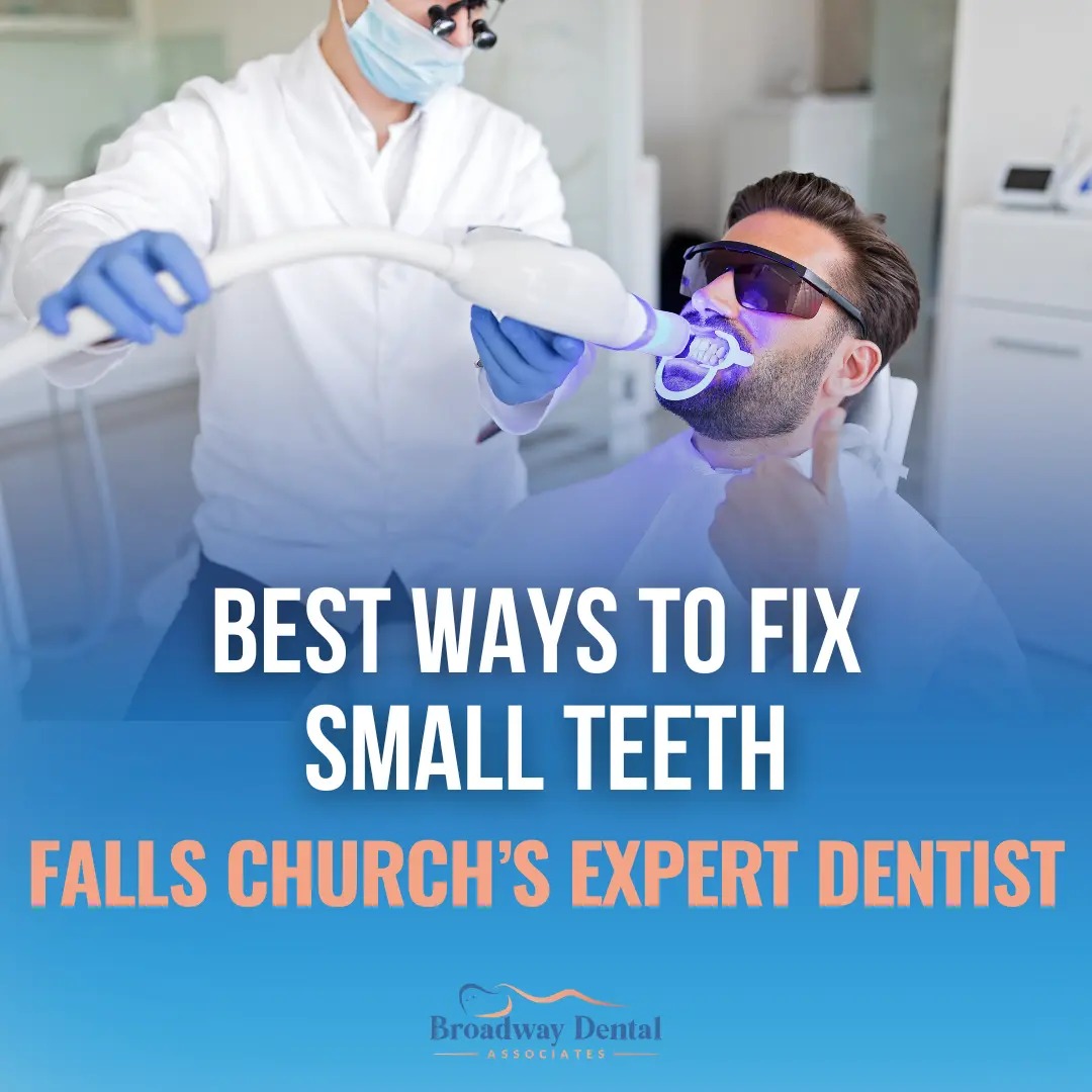Patient undergoing professional whitening and text saying: “Best Ways to Fix Small Teeth | Falls Church’s Expert Dentist” and Broadway Dental Associates logo in the bottom