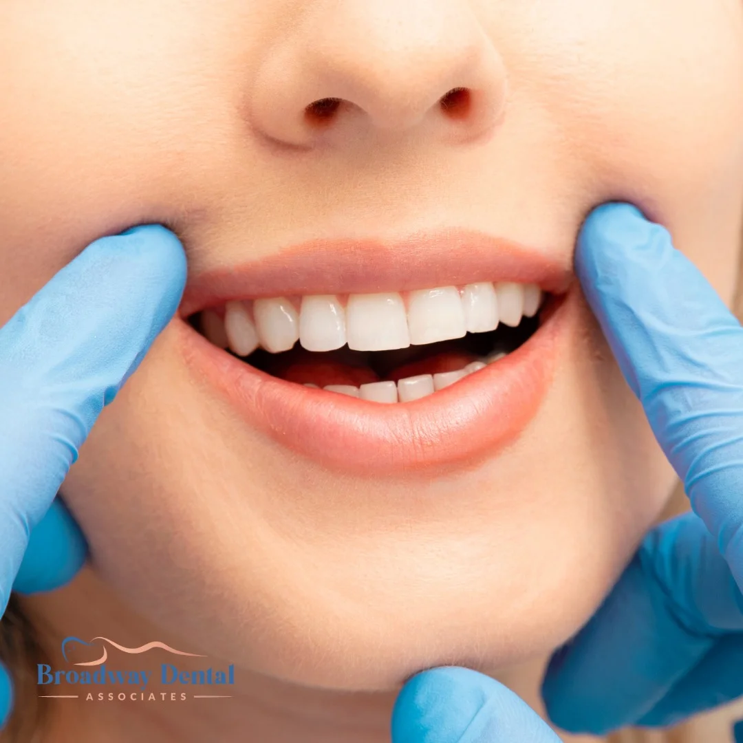 Close-up of bright white smile examination and Broadway Dental Associates logo in the bottom left of the image.